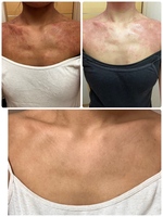 アトピーでお悩みの方のためのコース